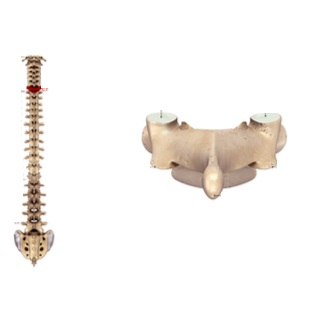 الفقرة العنقية الاستثنائية