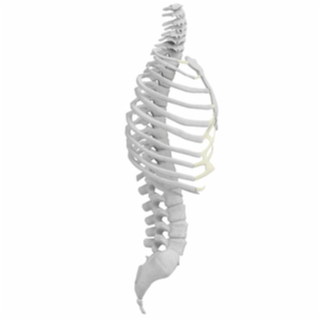 تركيب الفقرة العنقية الاستثنائية