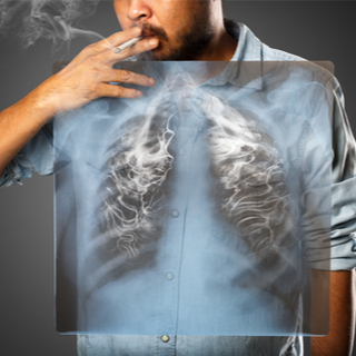 السبب الرئيسي للإصابة