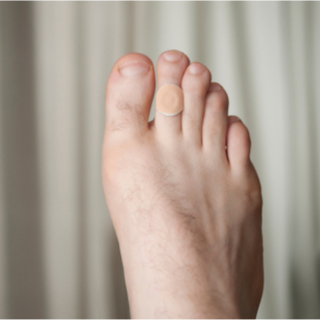 العلاج الطبي لمسمار القدم