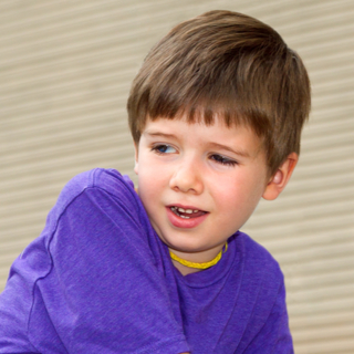 تدلي الجفون