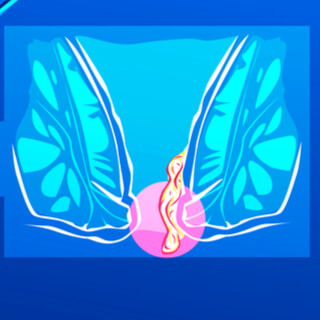 أعراض البواسير الهابطة