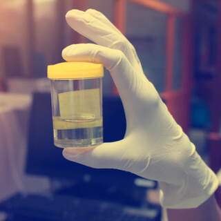 كيفية إجراء فحص البول