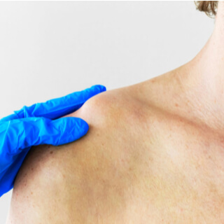 أعراض كسر عظمة الترقوة