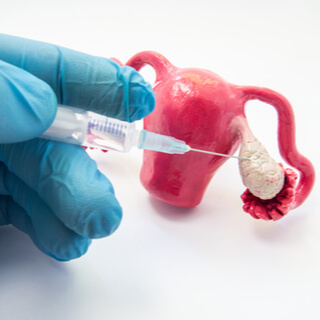 2. تحريض الإباضة