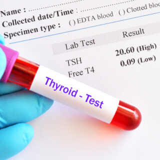 فحوصات الغدة الدرقية