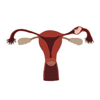 مكان حدوث الحمل خارج الرحم