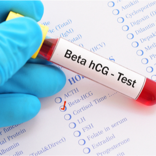 اليوم التاسع