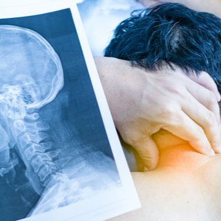 علاج الآلام الرقبة الناتجة عن الإنزلاق الغضروفي