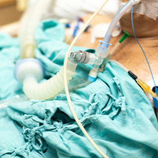 دواعي استخدام جهاز التنفس الصناعي 