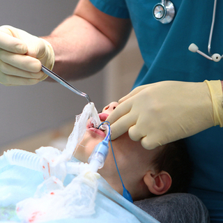 متى يمكن إزالة جهاز التنفس الصناعي 