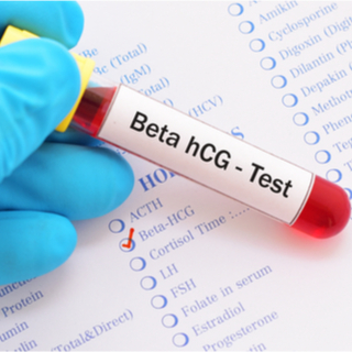 3. اختبار الحمل الكمي ( Quantitative hCG test)