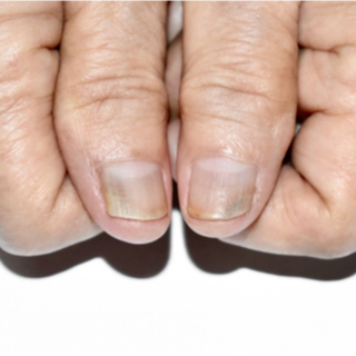 الانتباه إلى علامات المرض