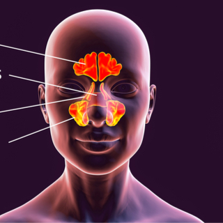 أنواع الجيوب الأنفية