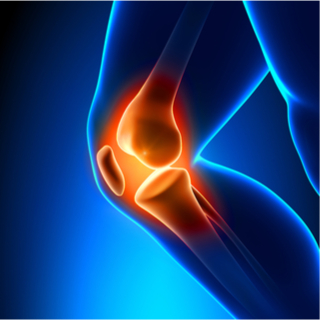 أسباب مرضية لألم مفصل الركبة
