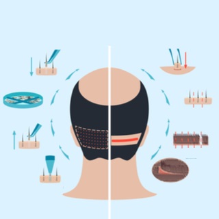 الخطوة الأولى