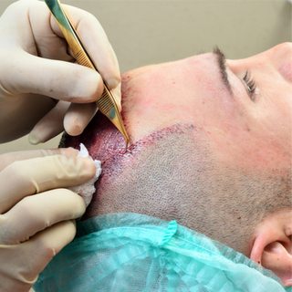 الخطوة الثالثة