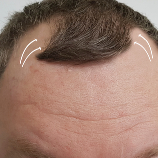 إجراءات المتابعة