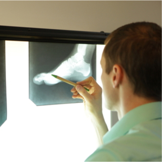 تشخيص شوكة القدم