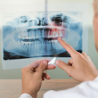 الأشعة السينية