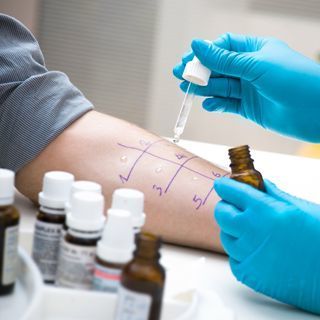 تشخيص الحساسية