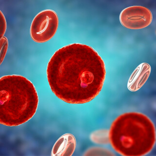 هل مرض الملاريا معدي؟