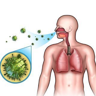 الإصابة بالالتهاب الرئوي