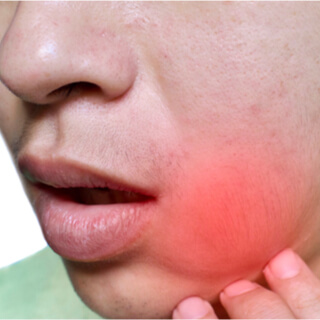 1. تورم في الفك