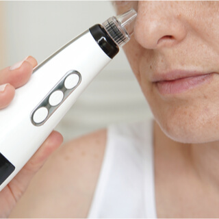 أداة إزالة وشفط الرؤوس السوداء والبيضاء