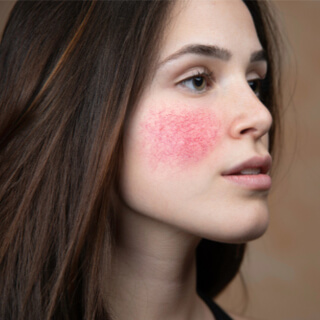 4. تفتيح لون البشرة وتهدئتها