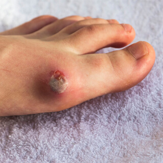 5. الحفاظ على مستوى السكر 5. الحفاظ على مستوى السكر