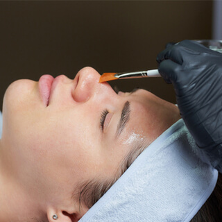 1. التقشير الكيميائي السطحي