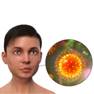 الهربس البسيط