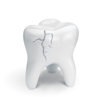 5. تكسر الأسنان