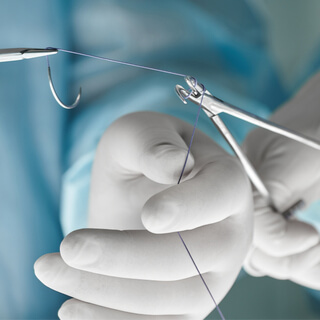 أنواع الغرز الجراحية من ناحية قابلية امتصاصها