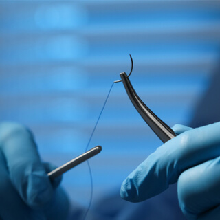 2. الغرز الغير قابلة للامتصاص