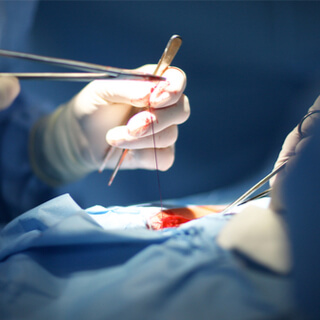 5. الغرز الصارة (Purse-string sutures)