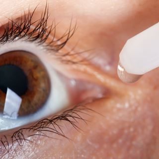 10. نصائح لإزالة العدسة