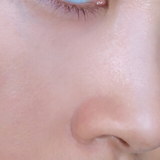 3. التخلص من الزيوت الزائدة 3. التخلص من الزيوت الزائدة