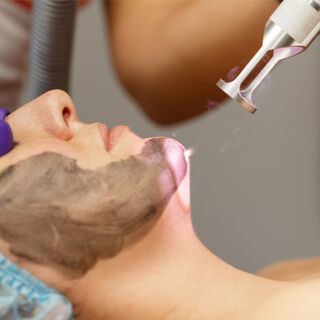 2. التخلص من خلايا الجلد الميتة 2. التخلص من خلايا الجلد الميتة