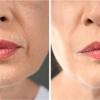 5. شد الجلد وتفتيح البقع الداكنة 5. شد الجلد وتفتيح البقع الداكنة