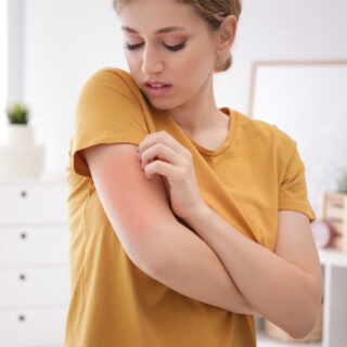 6. حكة في الجلد