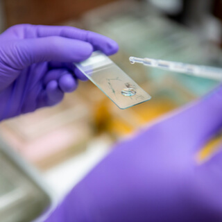 نتائج مسحة عنق الرحم الطبيعية