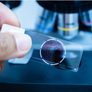 نتائج مسحة عنق الرحم الغير طبيعية