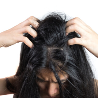 2. جفاف فروة الرأس