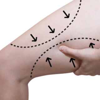 4. شد الفخذ العامودي