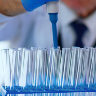 قبل عملية زراعة الكلى