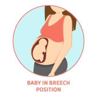 أسباب خلع الولادة أسباب خلع الولادة