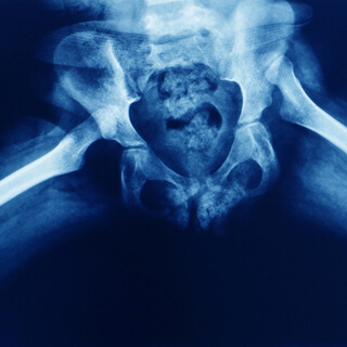 أهمية ارتداء جهاز خلع الولادة أهمية ارتداء جهاز خلع الولادة