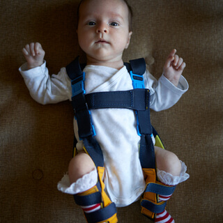 طريقة تلبيس جهاز خلع الولادة للطفل طريقة تلبيس جهاز خلع الولادة للطفل